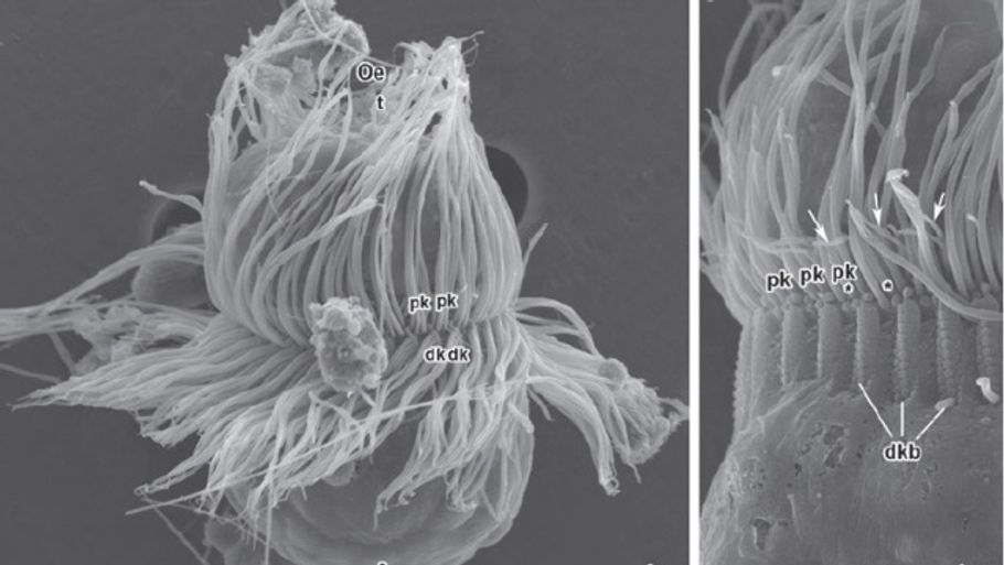 Mesodinium chamaeleon er hverken plante eller dyr. Ved hjælp af sine hundredvis af små hår, piler den igennem vandet og finder en plante, som den spiser. Derefter forvandler den sig selv til en plante. (Foto: Øjvind Moestrup/The Journal of Eukaryotic Microbiology)