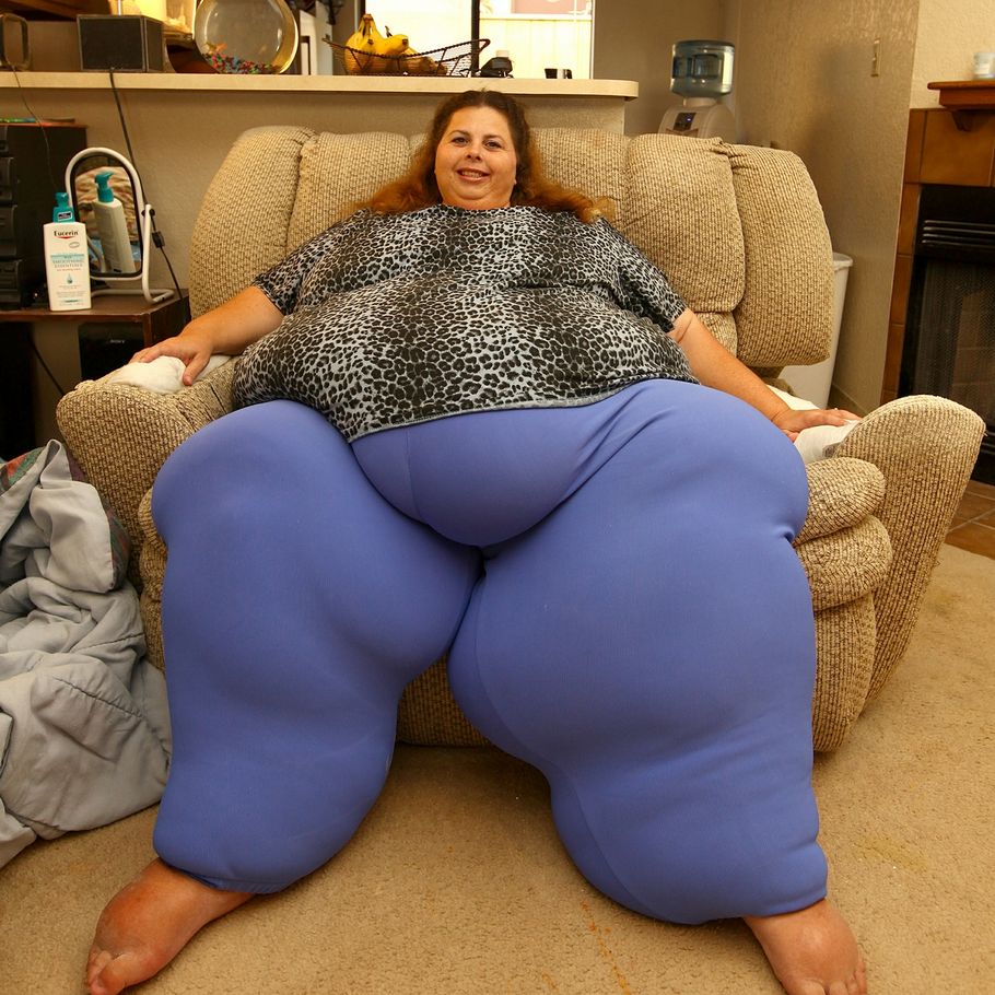 Verdens fedeste kvinde Tabte 45 kilo ved at dyrke sex billede