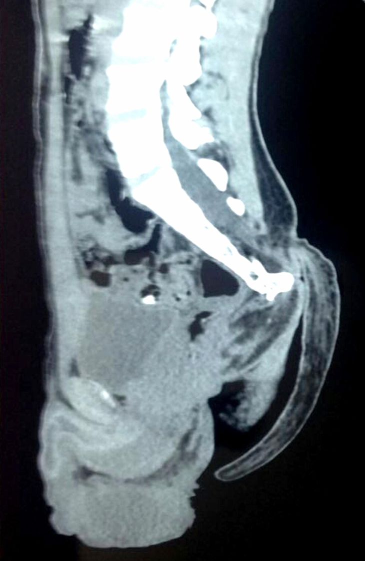 Et røntgenfoto viser halebenets størrelse. Foto: AP