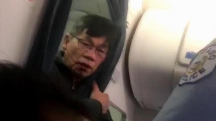 David Dao, 69, fik en regulær blodtud, da han blev fjernet fra flyet. (Foto: AP)