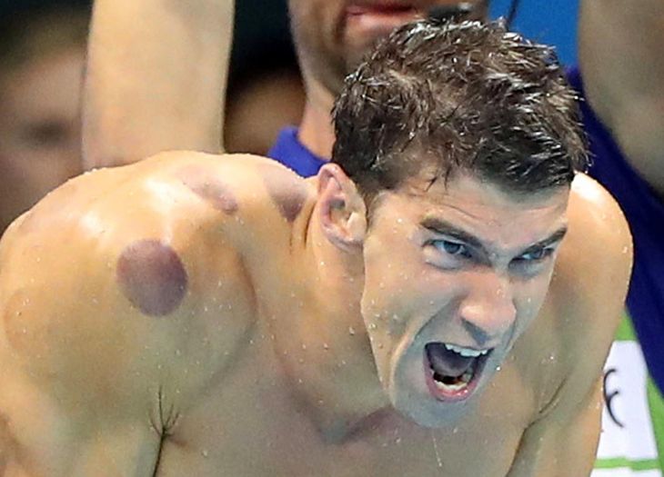 Michael Phelps er glad for, at han ikke begik selvmord. Foto: AP