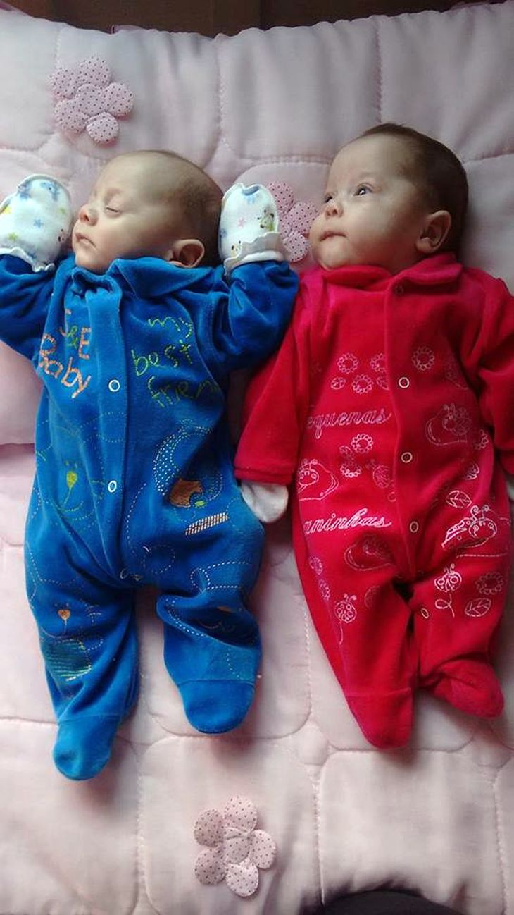De to tvillinger, den lille baby-dreng Asaph og hans tvillingesøster Anne Vitoria blev født ved kejsersnit i februar måned. Men tilbragte efterfølgende tre måneder i kuvøse.(Foto: Caters)   
