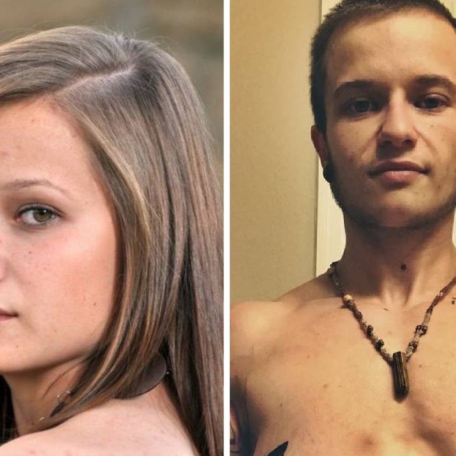 Transkønnet mand står frem med sine tapede bryster billede