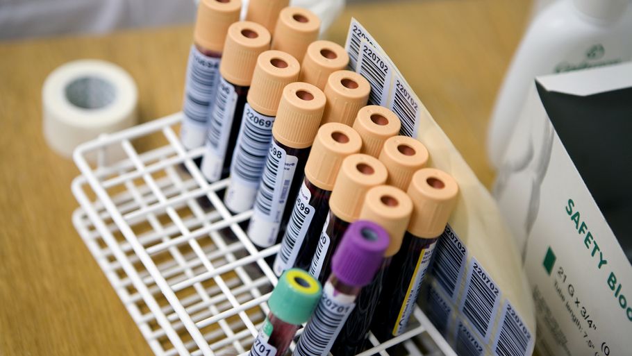 Amerikanske forskere har udviklet en metode til at analysere blodprøver, så de kan påvise visse typer kræft. Nu skal de indledende resultater testet i et større forsøg. Arkivfoto: Sara Galbiati/Ritzau Scanpix