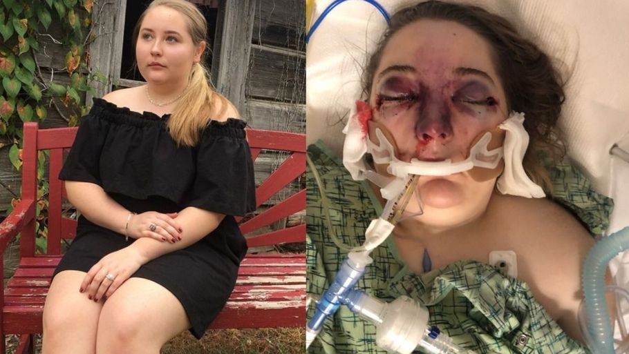Teenagepigen Jordan Wylker blev syg efter en krydstogtferie. Nu har hun mistet synet. Foto: GoFundMe