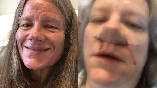 Dwelling Northern Fugtig Afhængig af næsespray: Nu har hun fundet løsningen – Ekstra Bladet