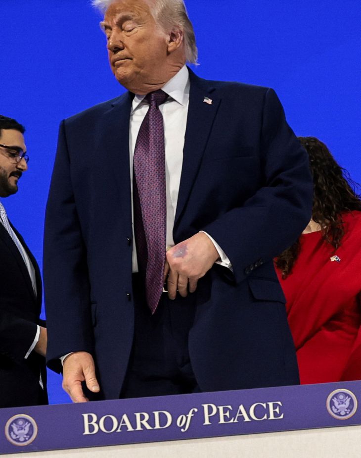 Trumps blå hånd: Nu forklarer han det selv – Ekstra Bladet